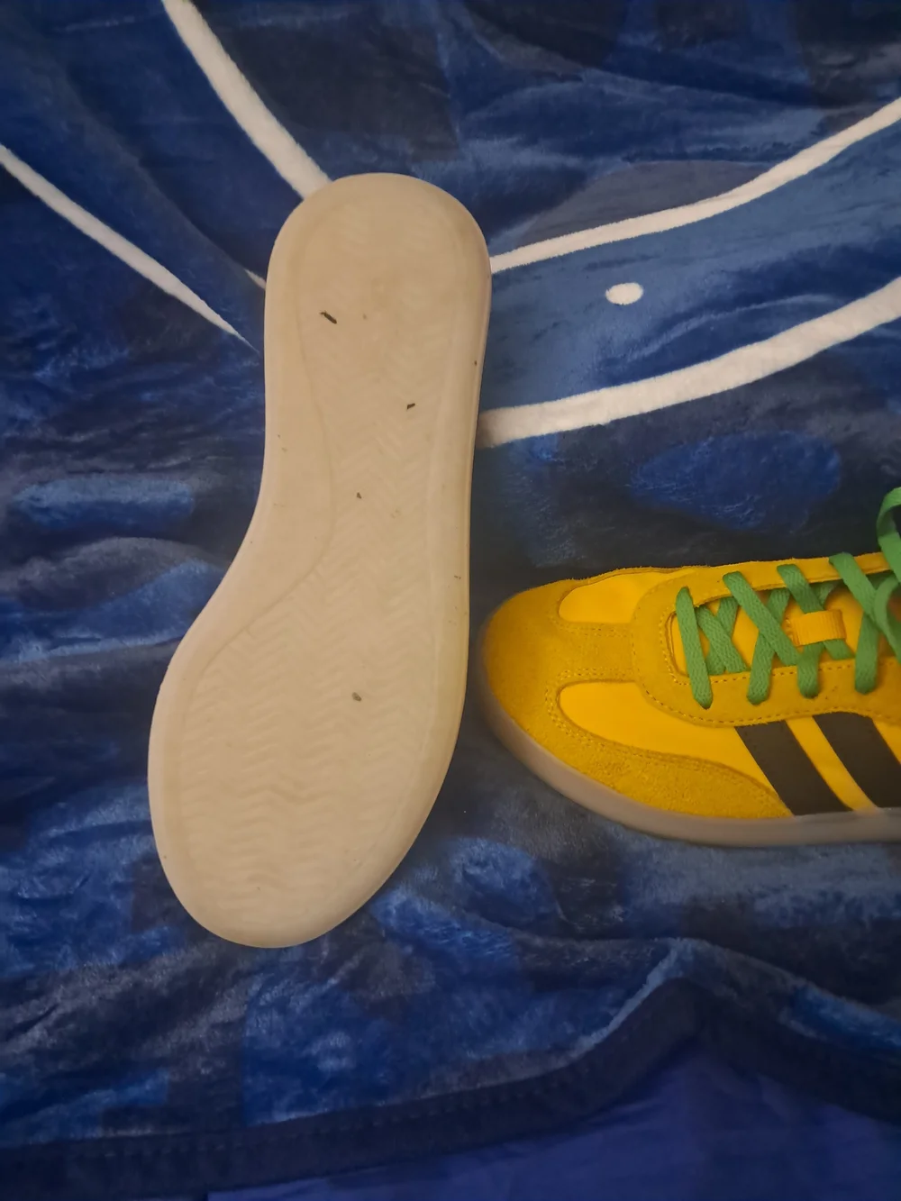 Adidas Yellow Sneakers with Black Stripes and Green Laces